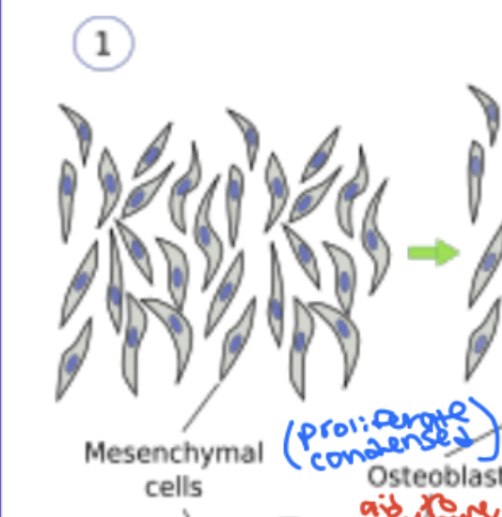 <p>IBF: Step 1 of Intramembranous bone formation</p>