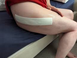 <p>What bandaging technique should be used for this injury?</p>