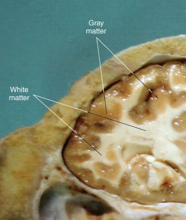 <p>• Composed of neuronal cell bodies </p><p>• Appears brownish-gray grossly </p><p>• Found in the cortex of the cerebrum and cerebellum</p>