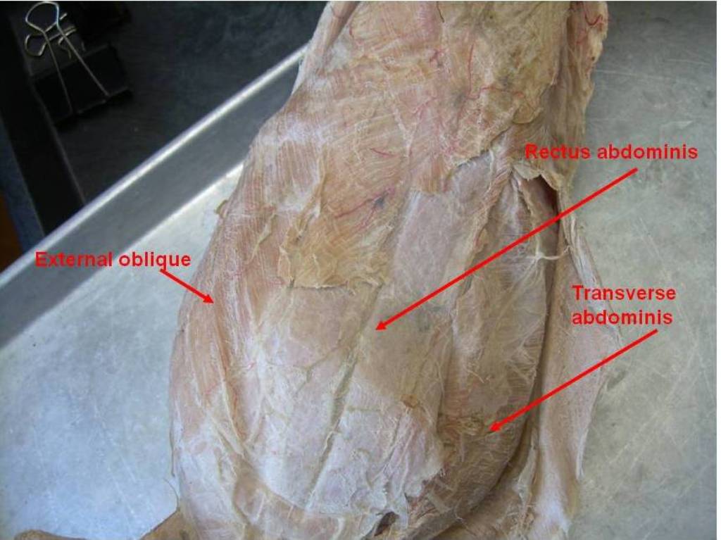 <p>Abdominal Wall</p>