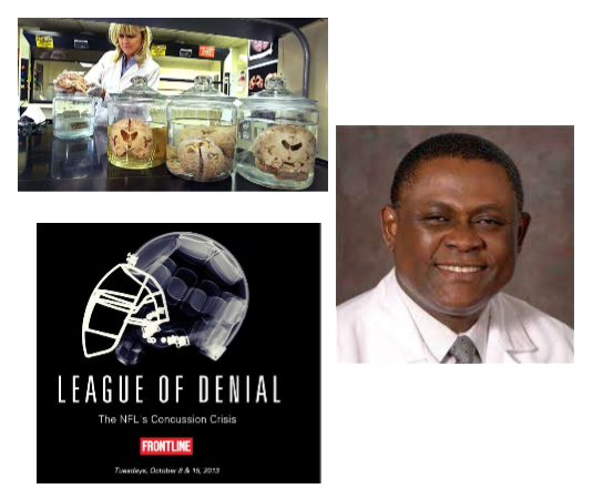 <p>One of the leading experts: Dr. Ann McKee. First noticed in NFL players: Dr. Bennet Omalu. Pittsburgh Steelers - Mike Webster. Brain looked like it was someone in there 70’s or 80’s and looked like Alzheimers. Neurodegeneration</p>