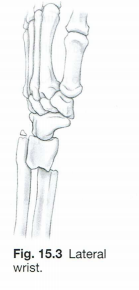 <p>Which specific named fracture does Fig. 15.3 illustrate? Which bone is most commonly fractured, and which displacement commonly occurs with this fracture? Describe the type of injury or fall that commonly results in this type of fracture.</p>