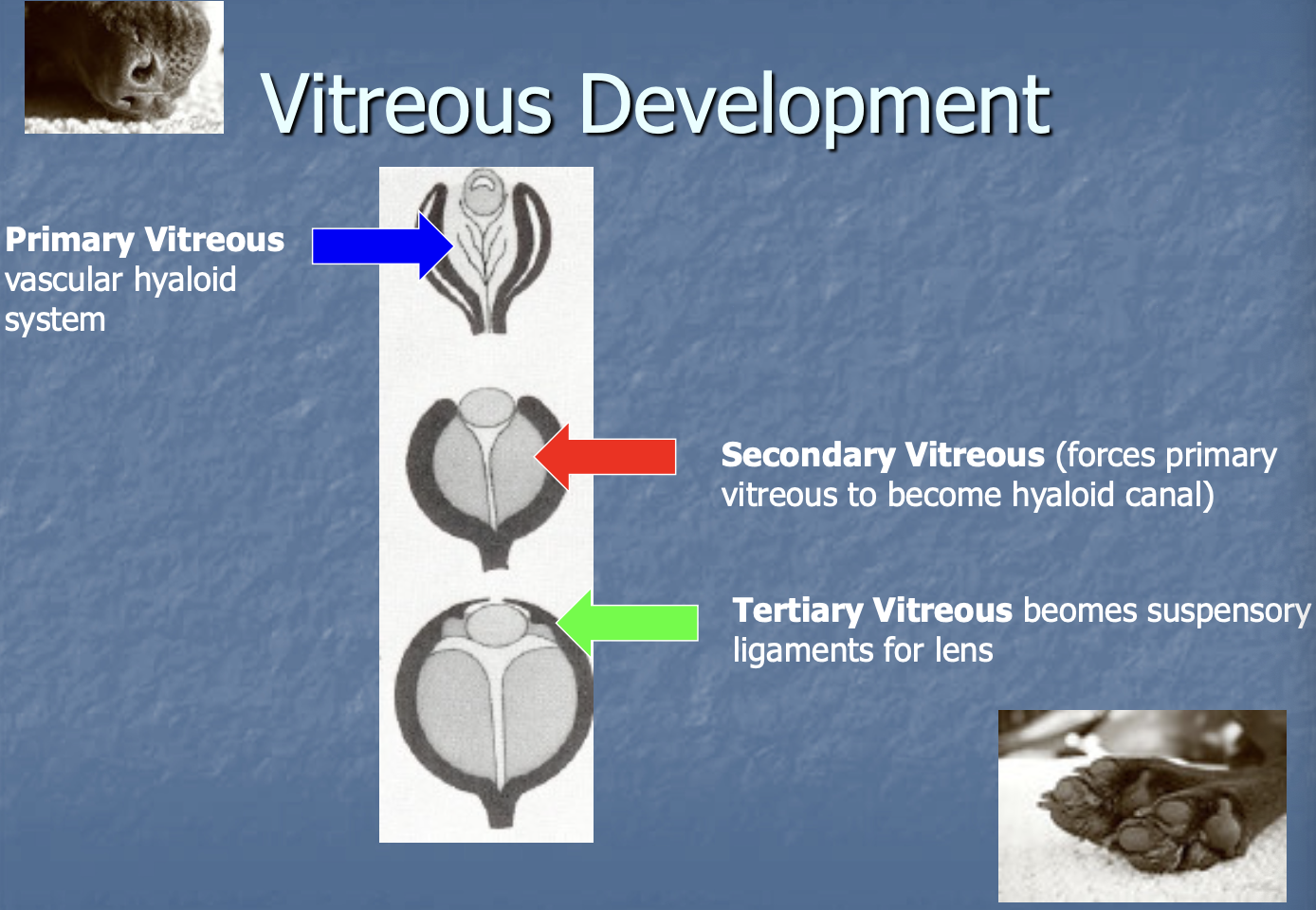 <p>Primary - vascular hyaloid system.</p><p>secondary - forces primary to become hyaloid canal.</p><p>tertiary - becomes suspensory lgmt for lens.</p>