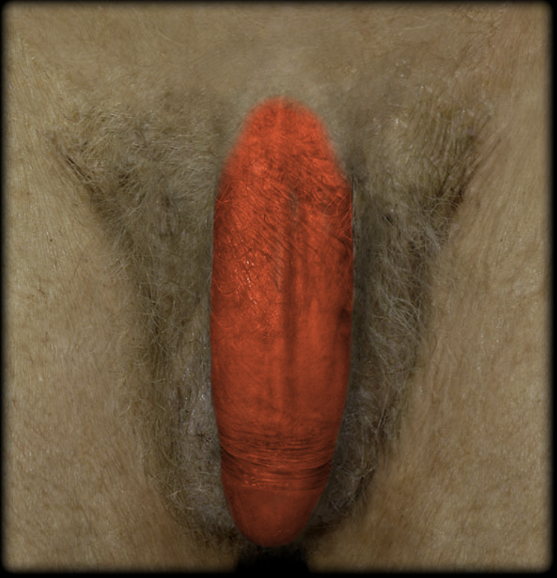 term image
