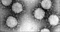<p>Acellular microbes (no cells) made up of proteins and genetic material (DNA or RNA)</p><p>- Can infect all types of cells, don't move outside of host organisms and multiply in host cells</p>