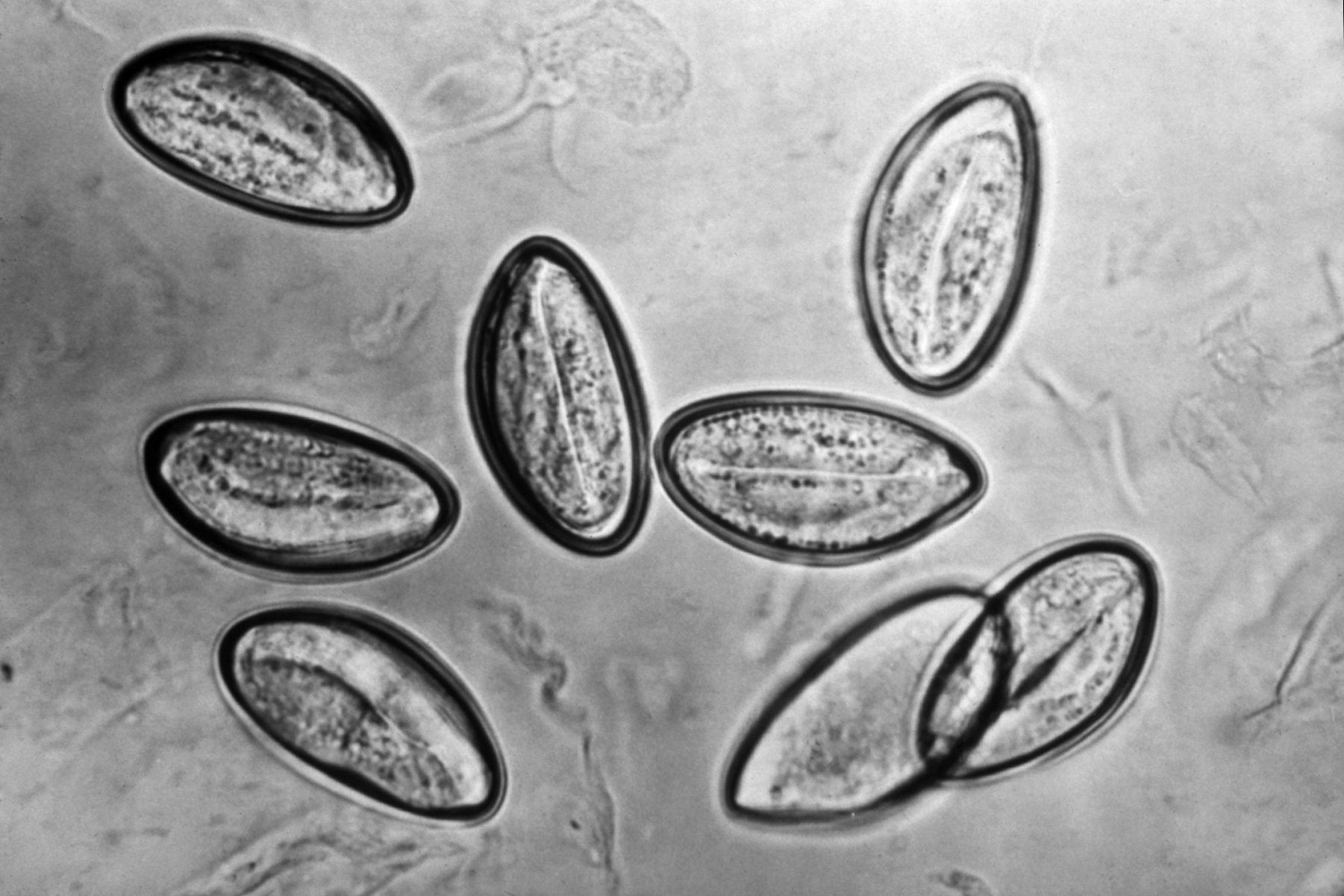 <ul><li><p>most common </p></li><li><p>50-60 long by 20-30 micrometers wide </p></li><li><p>oval thick colorless shell flattened on one side </p></li><li><p><strong>look like letter D </strong></p></li></ul><p></p>