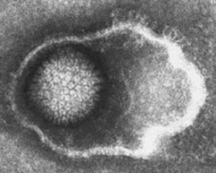 <p>Herpesviridae.</p>