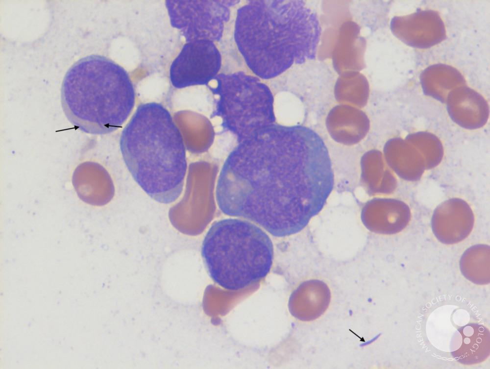 <p>Identify</p>