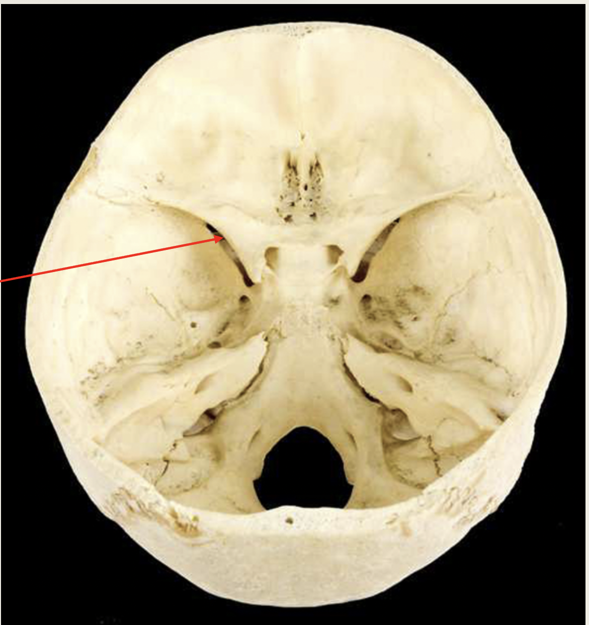 <p>Oculomotor</p><p>Nerve (III)</p><p>■ Function: XX XX (XX)</p><p>■ Passes through</p><p>XX XX XX</p><p></p>