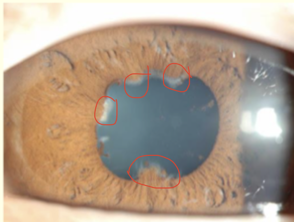 <p>Describe and give a diagnosis </p>