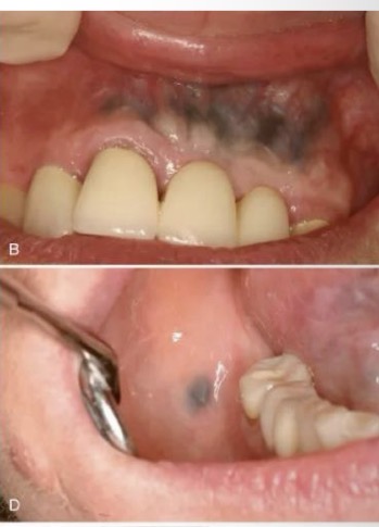 <p>CHẨN ĐOÁN</p>