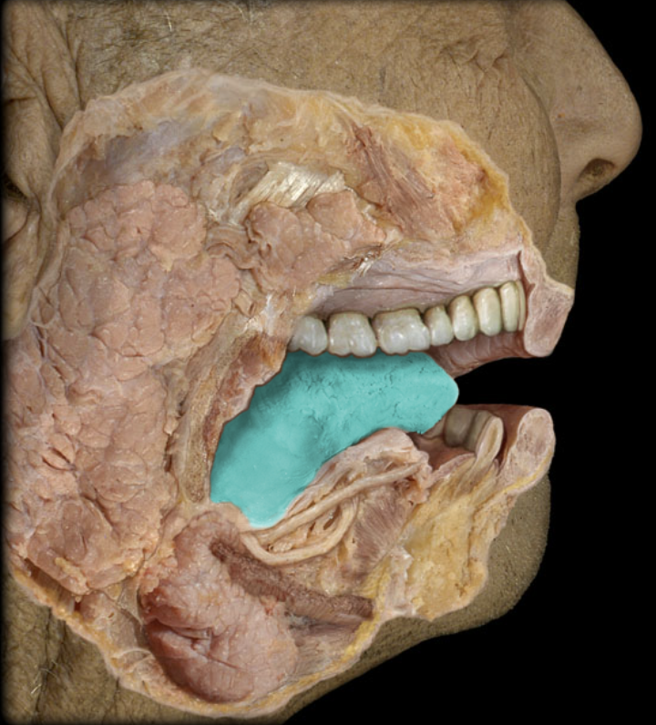 term image