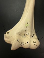 <p>raised area of bone on or above a condyle</p><p>ex: medial __ of the humerus is above the trochlea</p>