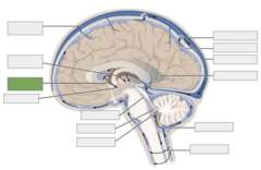 <p>This is the</p>