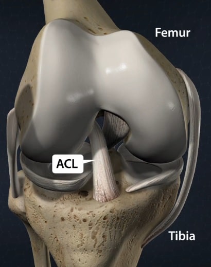 <p><strong>ACL</strong></p>