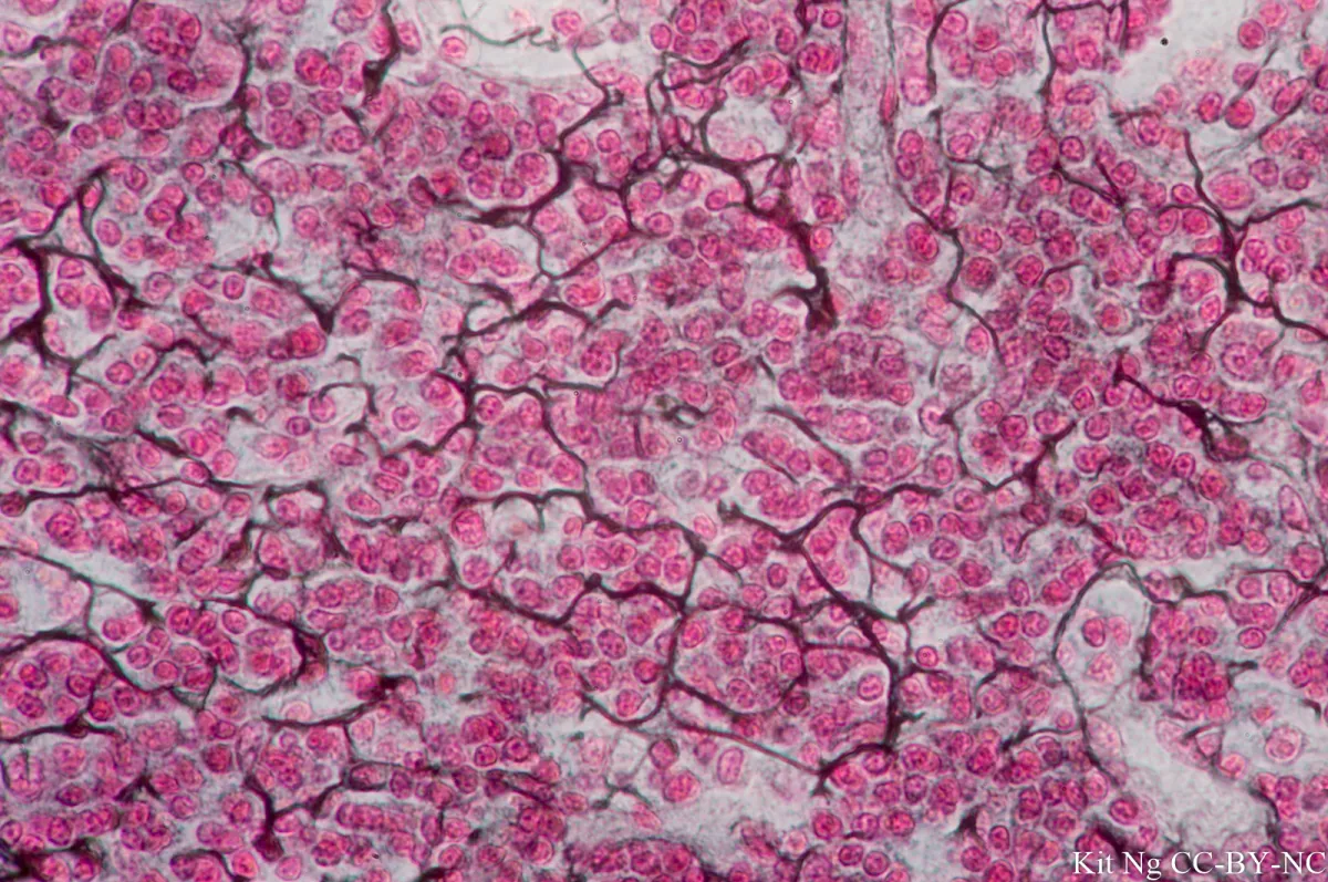 <p>Reticular</p>