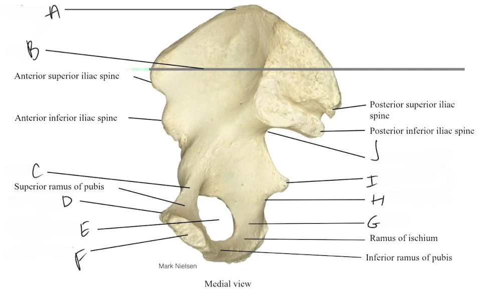 <p>obturator foramen</p>