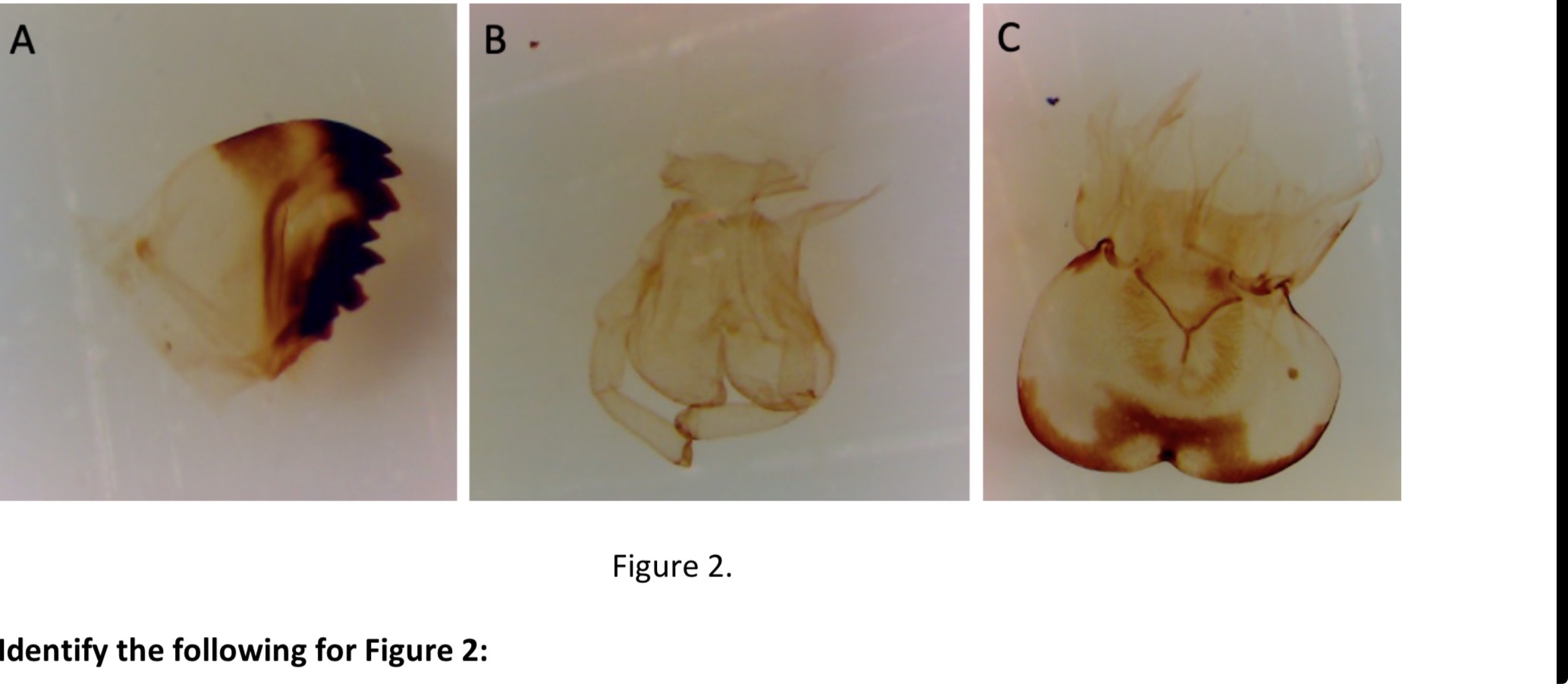 <p>Identify mouthpart B</p>