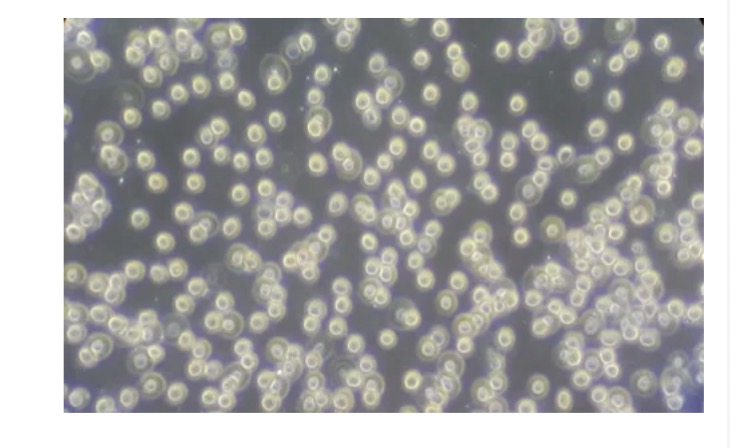 <p>Phase-contrast microscopy</p>