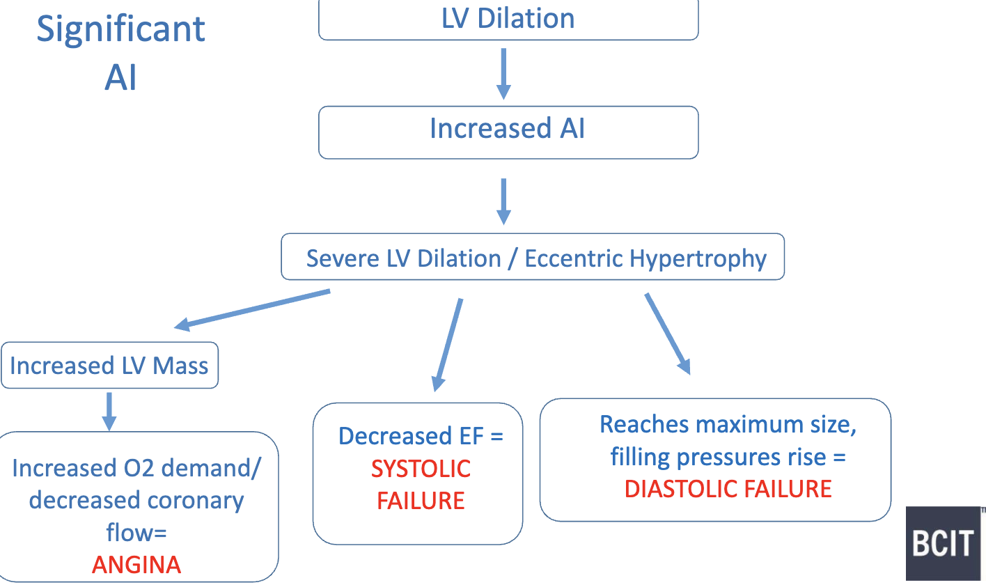 <ul><li><p>as LV dilates more: </p><ul><li><p>myofibrils pass their optimal length and contractility decreases → <strong>EF decreases </strong>and eventually patient goes into <strong>systolic heart failure </strong></p></li><li><p>pericardium reaches max size, cannot accommodate excess blood → <strong>LV filling pressure increase → diastolic heart failure </strong></p></li><li><p></p></li></ul></li></ul><p></p>