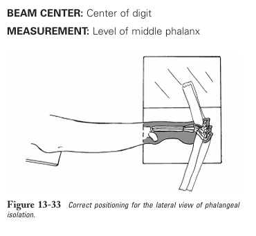 <p>lateral view of metacarpus-phalanges</p>