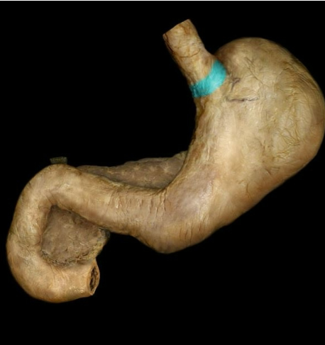 term image