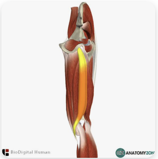 <p>O: Tuberosity of the ischium; sacrotuberous ligament</p><p>I: Pes anserinus (proximal tibia)</p><p>A: Flexion of the leg; internal rotation of the flexed leg; extension of the thigh</p><p>N: Tibial nerve</p>