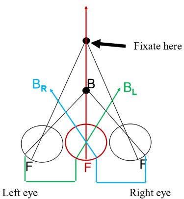 <p><strong>Crossed </strong>diplopea. </p><p>object is <strong>closer </strong>than fixation —> image on temporal retina of both eyes. </p><p><em>left eye image appears on right, right eye image appears on left. </em></p><p>Remember - corresponding points will give rise to one nasal and one temporal! </p>