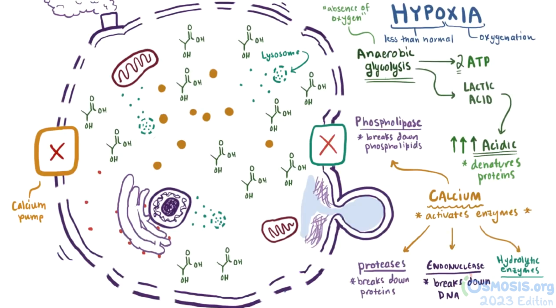 <p><strong>Hypoxia</strong><span> (oxygen deficiency) disrupts </span><strong>aerobic oxidative respiration</strong><span>, the primary source of cellular ATP. This energy failure triggers a metabolic crisis that initially allows for survival through backup mechanisms but eventually leads to enzymatic self-digestion of the cell</span></p>