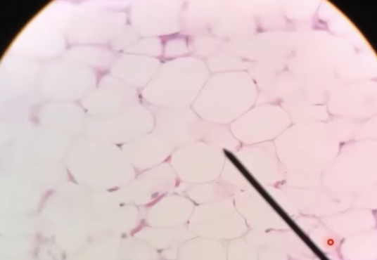 <p>connective tissue that has air bubbles (fat/lipids) </p>