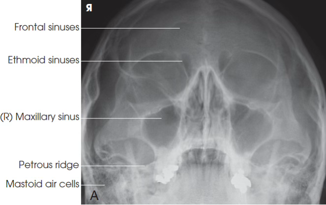 <p>What view is this?</p>
