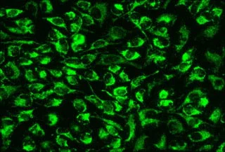 <p>Positive: Mitochondrial Fluorescence (ring appearance)</p><p>Negative: No Fluorescence</p>