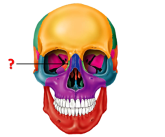 <p>Identify this bone (green).</p>