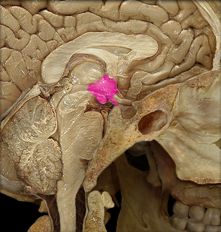 term image