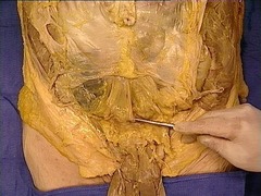 <p>Identify the structure</p>
