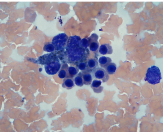 <p>red cell production happens in islands </p><p>in the spleen</p>
