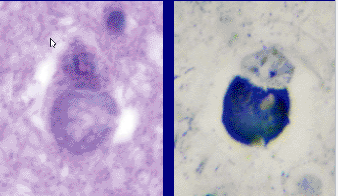 term image