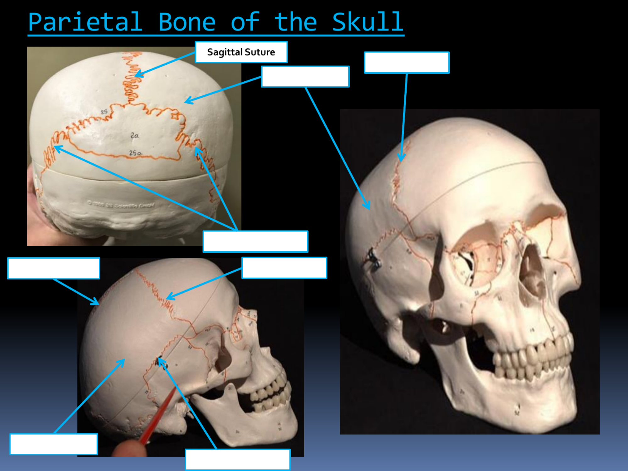 <p>Sagittal Suture</p>