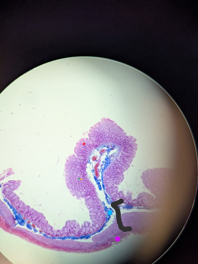 <p>Where in the body is this</p>