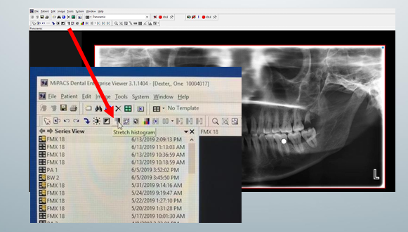 <p>-although the brightness and contrast can be judged visually, the image histogram is a convenient tool to examine which of the available gray values the image uses</p><p>-open the image that you want to work on and click at arrow</p>