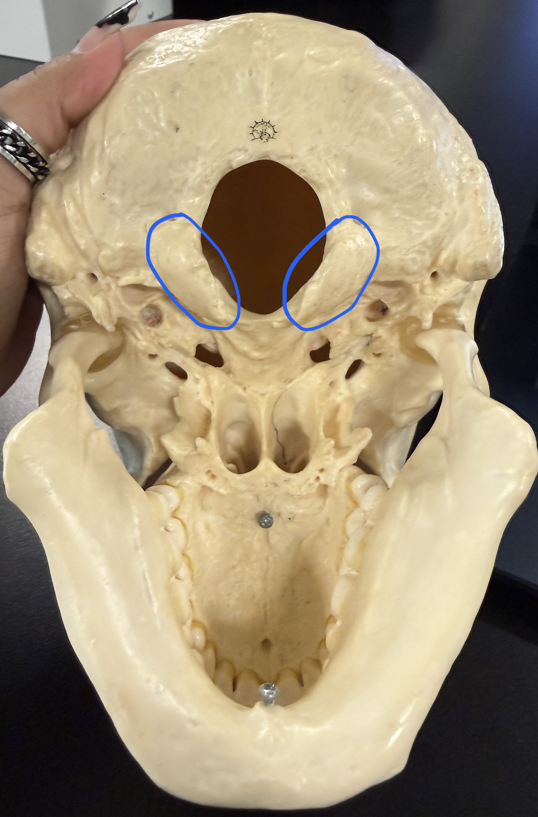 <p>articulates w/ C1 (atlas)</p>