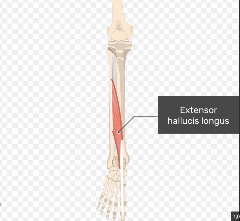 <p>Extensor Hallucis Longus</p>