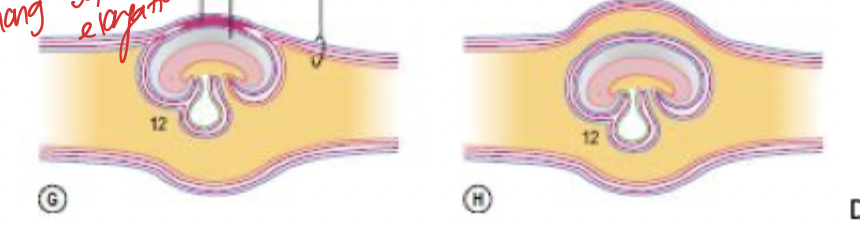 <p>in ruminants and pigs chorion and dorsal portion of amnionitic wall remain fused in mesamnion </p><p>In horses, dogs, cats the allantois surrounds amnion completely </p>