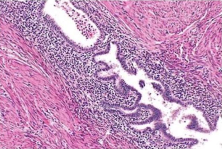term image