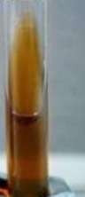 <p><strong>no growth</strong> or <strong>growth with no color change</strong> (the medium remains amber/yellow). [1, 2]</p><p></p><ul><li><p><span><strong>Appearance:</strong> Normal amber/yellow color of the medium with no blackening, regardless of whether bacterial growth occurred.</span></p></li><li><p><span><strong>Indications:</strong> Most other streptococci species, which are either inhibited by the bile salts or cannot hydrolyze esculin.</span> [1, 2, 3, 4, 5]</p></li></ul><p></p>