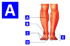 <p>leg</p>