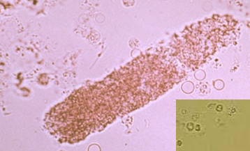 term image