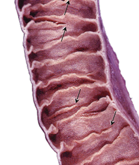 <p>Permanent folds of mucosa and submucosa that increase absorptive surface area; prominent in the <strong>distal duodenum and jejunum</strong> and decrease toward the ileum</p>