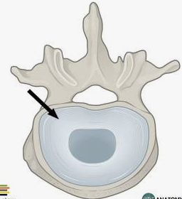<ul><li><p>The tough outer ring of the disc. </p></li><li><p>Made of fibrocartilage</p></li><li><p>Disc herniation happens here</p></li></ul><p></p>