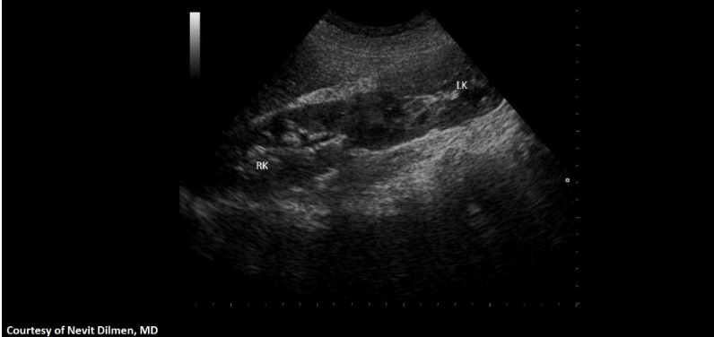 term image